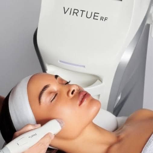 3 RF Microneedling at Laser Options by Jen in Scottsdale, AZ