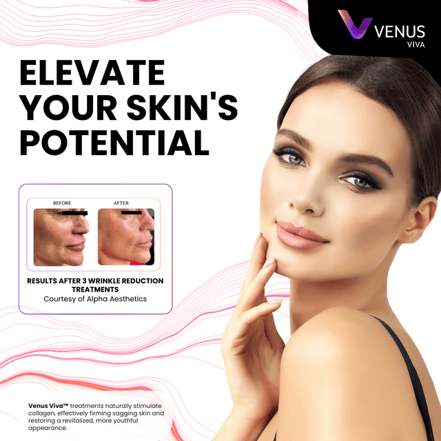 3 RF Skin Tightening at Laser Options by Jen in Scottsdale, AZ